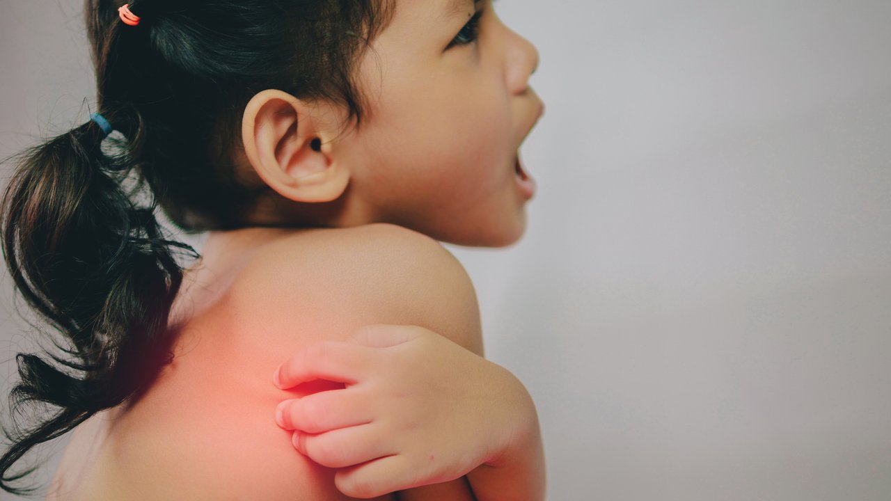 Impetigo contagiosa (Grindflechte, Borkenflechte)