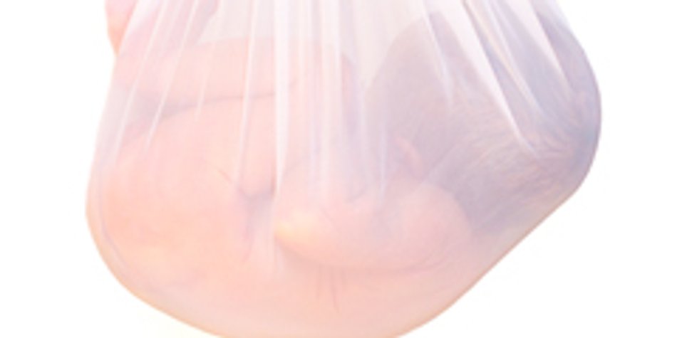 "Bio-Bag": Künstliche Gebärmutter für Frühgeborene "Bio-Bag": Künstliche Gebärmutter für Frühgeborene