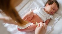 Nabelbruch beim Baby behandeln: Klingt schlimmer, als es ist