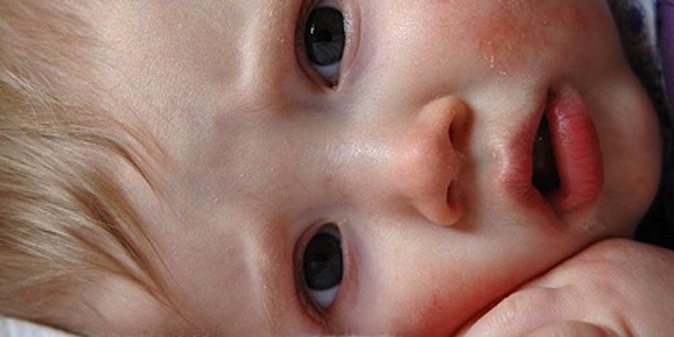 Babykrankheiten: Tipps, wenn das Baby krank ist Babykrankheiten: Tipps, wenn das Baby krank ist