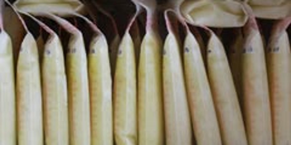 Dieses Foto beweist die heilende Kraft von Muttermilch Dieses Foto beweist die heilende Kraft von Muttermilch
