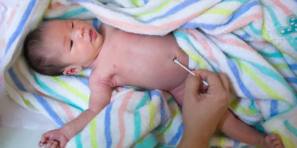 Babys: So wird der Nabel gepflegt Babys: So wird der Nabel gepflegt