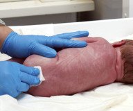 Vaginal Seeding: Vaginale Impfung für Kaiserschnitt-Babys