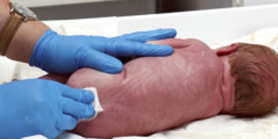 Vaginal Seeding: Vaginale Impfung für Kaiserschnitt-Babys Vaginal Seeding: Vaginale Impfung für Kaiserschnitt-Babys