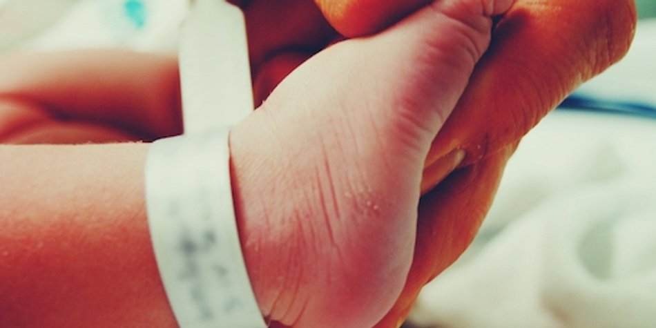 Sichelfuß beim Baby: So kann die Fehlstellung einfach behandelt werden Sichelfuß beim Baby: So kann die Fehlstellung einfach behandelt werden