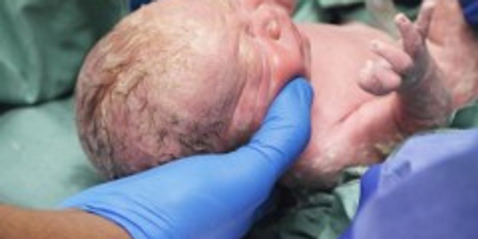 Dieses Baby wurde zweimal geboren Dieses Baby wurde zweimal geboren
