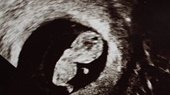 Die 9. Woche schwanger