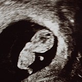 Die 9. Woche schwanger. Es ist ein Gummibärchen!