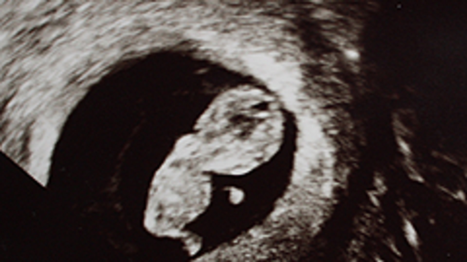 Wochen schwanger 9 9 Wochen
