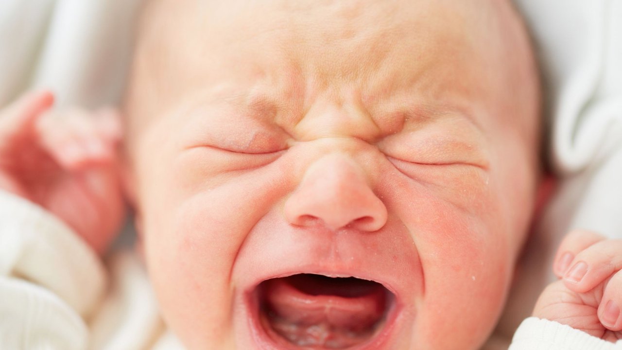 Verkürztes Zungenbändchen Baby