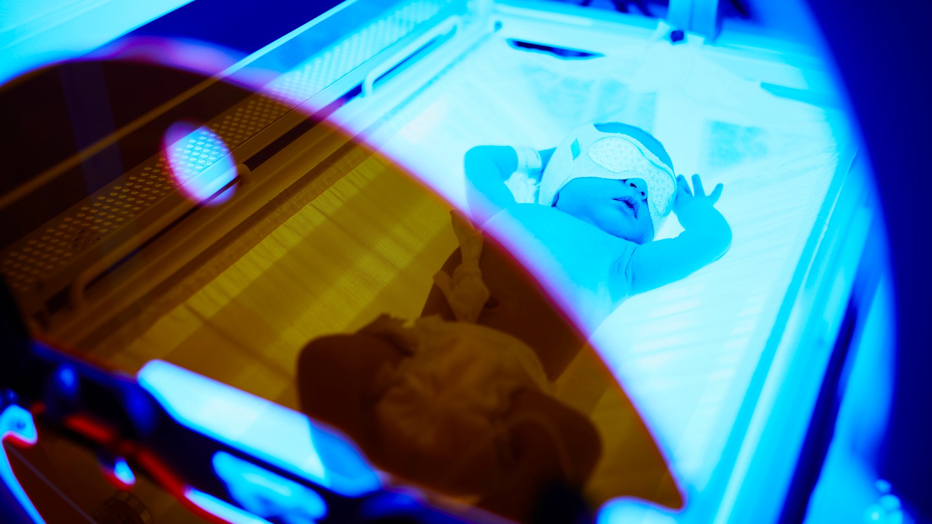 Blaulicht-Therapielampe, Professionelle Baby-Gelbsucht-Wund-Lampe