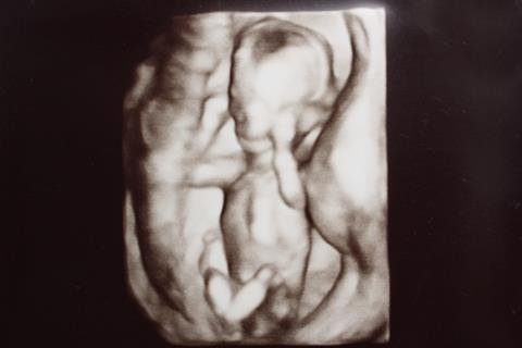 Embryo Fotus Fertiges Baby Alles Zur Entwicklung Familie De