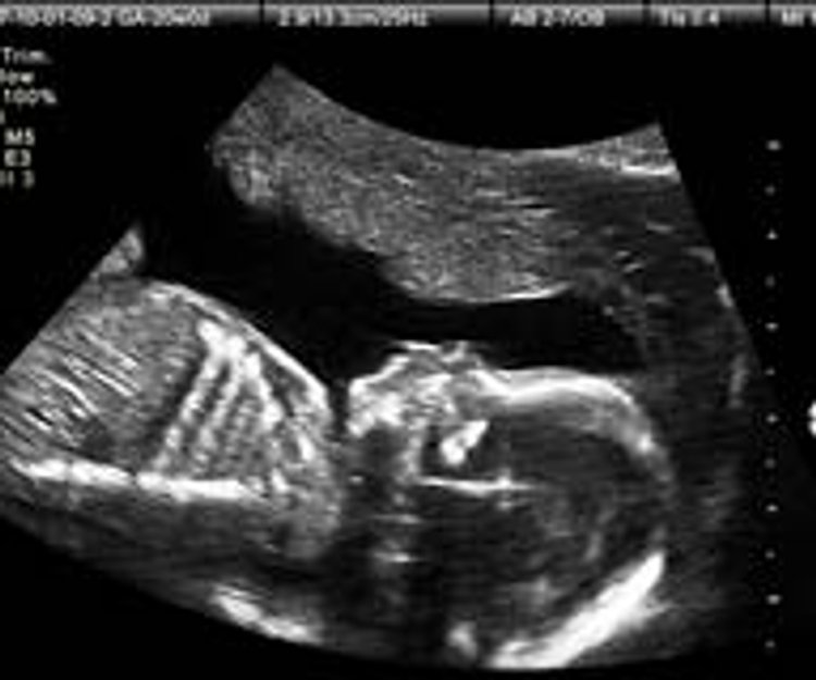 56 Top Photos Geschlecht Baby Wann / Schwangerschaft Wie Man Mit Der Nub Theorie Das Baby Geschlecht Fruh