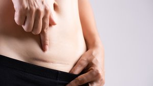 Runterschlucken: Diese 11 Sätze will keine Kaiserschnitt-Mama hören