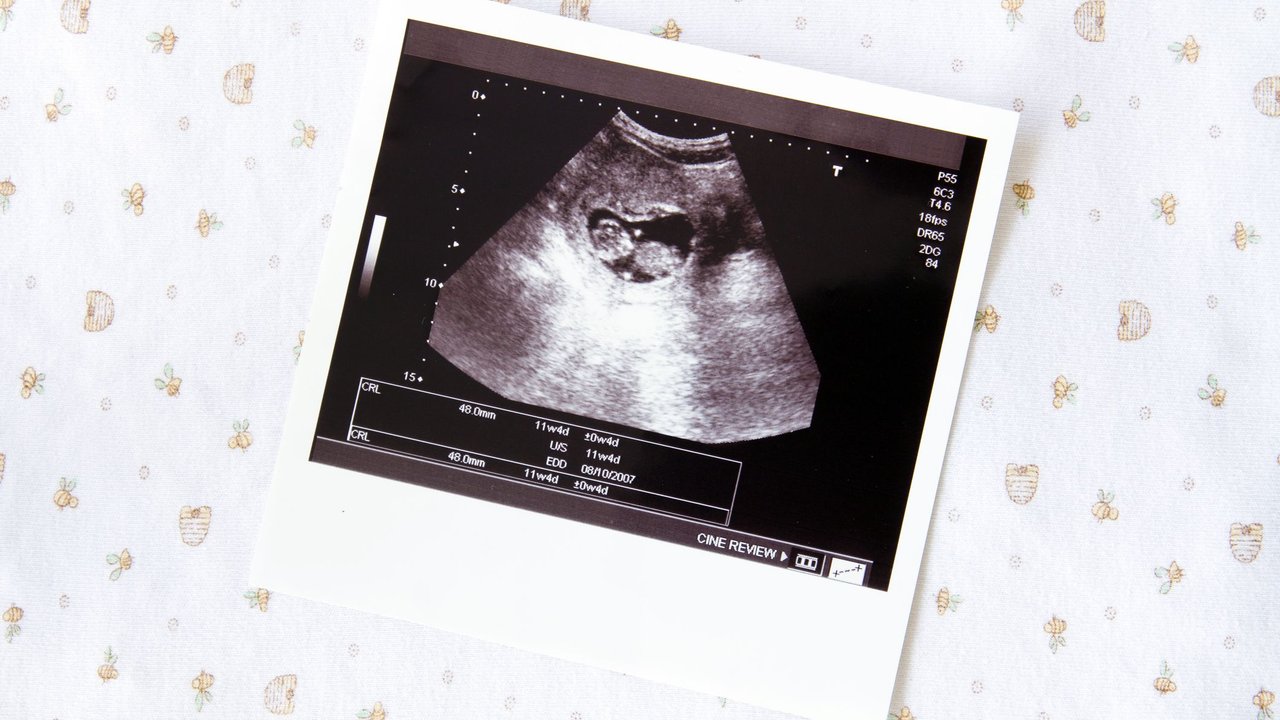 Embryo Entwicklung: Ultraschallbild 11+4 