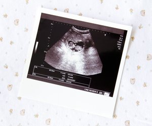 Embryo-Entwicklung: Was sich Woche für Woche beim Baby im Bauch tut