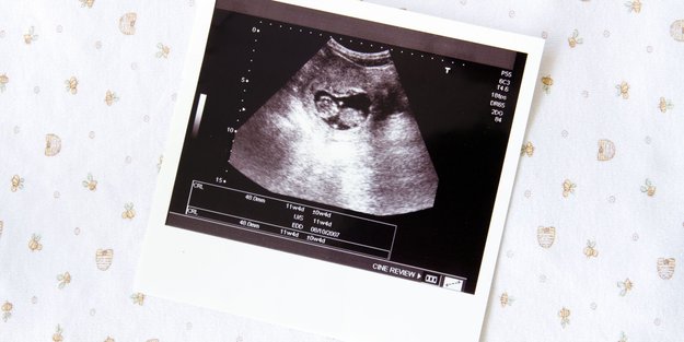 Embryo-Entwicklung: Was sich Woche für Woche beim Baby im Bauch tut