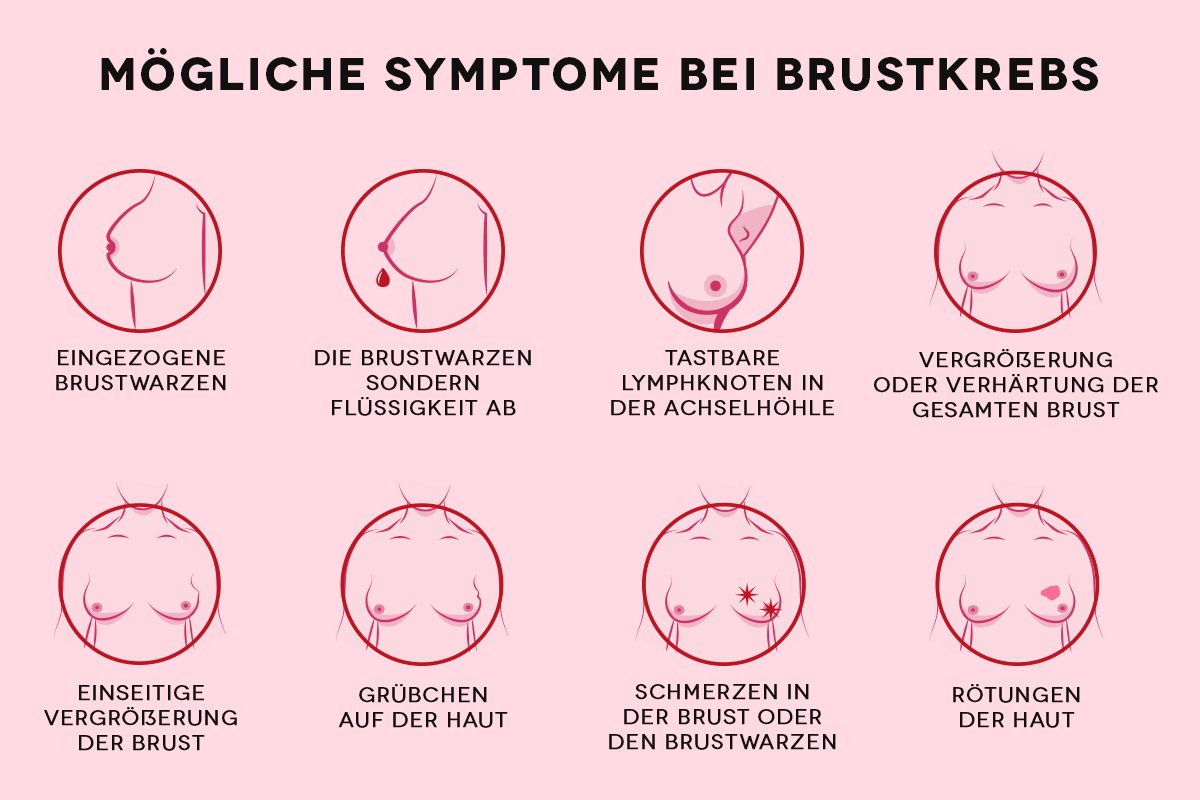 Brustkrebs beim mann: symptome