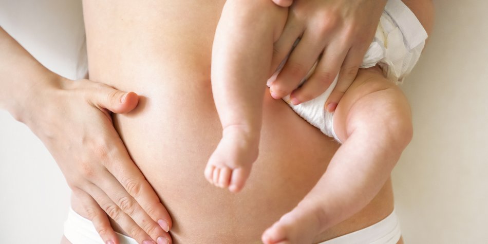 Nabelbruch nach Schwangerschaft: Warum in manchen Fällen eine OP nötig wird