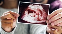 Schwangerschaft verkünden: Die 7 schönsten Ideen