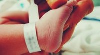Sichelfuß beim Baby: So kann die Fehlstellung einfach behandelt werden