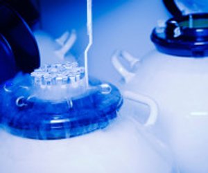 Samenzellen einfrieren: Die wichtigsten Fakten zur Kryokonservierung