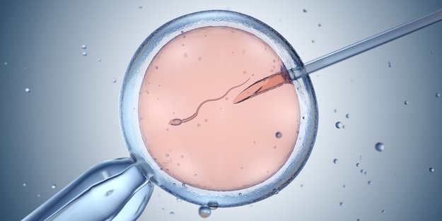Blastozystentransfer: Die Vorteile der IVF-Methode
