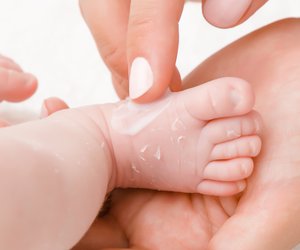 Trockene Haut bei Babys: Das könnte dahinter stecken