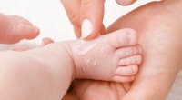 Trockene Haut bei Babys: Das könnte dahinter stecken