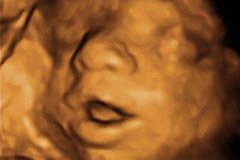 3d Ultraschall Faszinierendes Babywatching Familie De