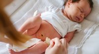 Nabelbruch beim Baby behandeln: Klingt schlimmer, als es ist