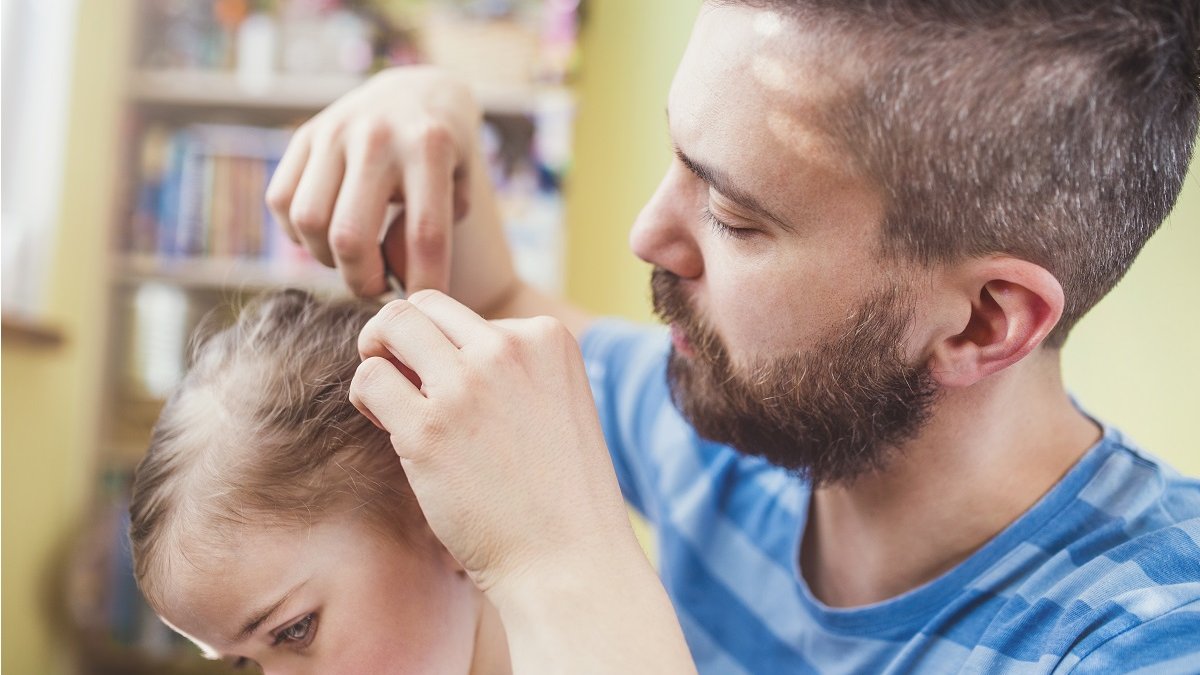 Haarausfall bei Kindern: Was sind die Ursachen?