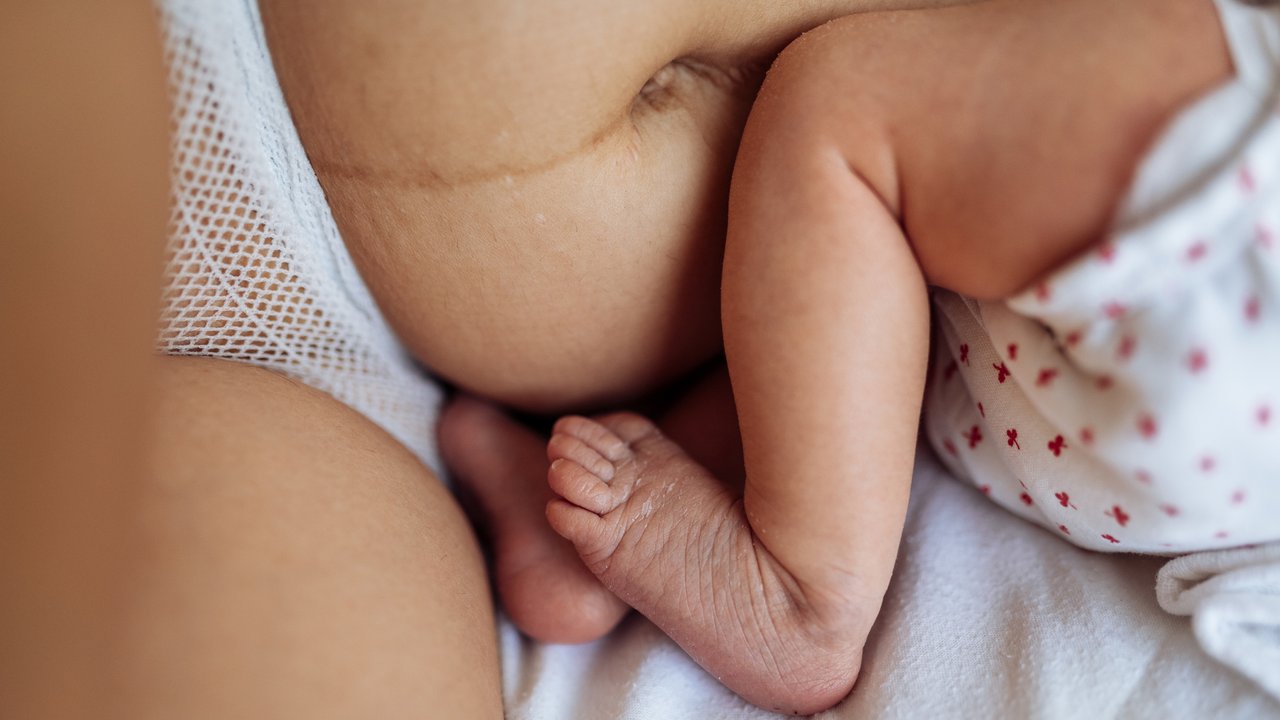 Life After Birth Project Schwangerschaft Geburt After-Baby Body