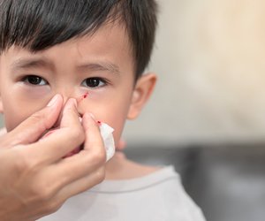 Nase blutet? Eltern müssen jetzt SO handeln