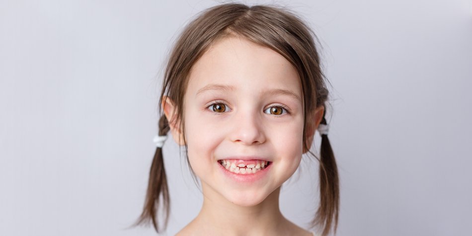 Backenzähne bei Kindern – neue Zähne trotz Wackelzähnen
