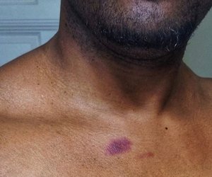 Foto von Still-Fleck auf Papas Brust geht viral