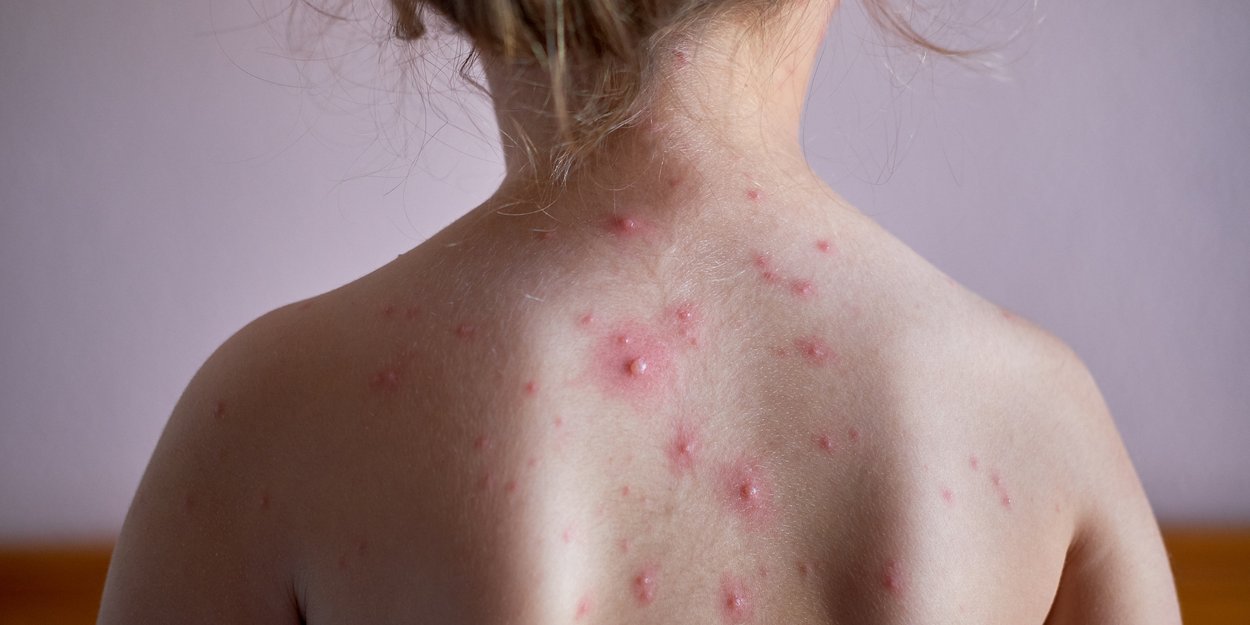 Kinderkrankheiten Von A Wie Asthma Bis Z Wie Zahnungsschmerzen Familie De