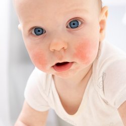 Trockene Haut bei Babys und Kindern: Hautärzte sagen, was wirklich hilft