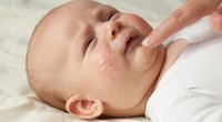 Neurodermitis: Wenn Babys Haut juckt
