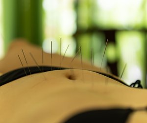 Akupunktur bei Kinderwunsch: Wie es helfen kann
