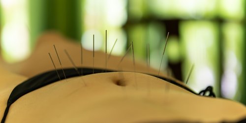 Akupunktur bei Kinderwunsch: Wie es helfen kann