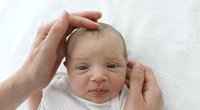 Fontanelle: Das kann die geniale Knochenlücke am Babykopf