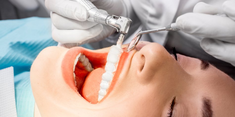 Zahnreinigung: Vorteile, Ablauf und Kosten der Behandlung vom Profi