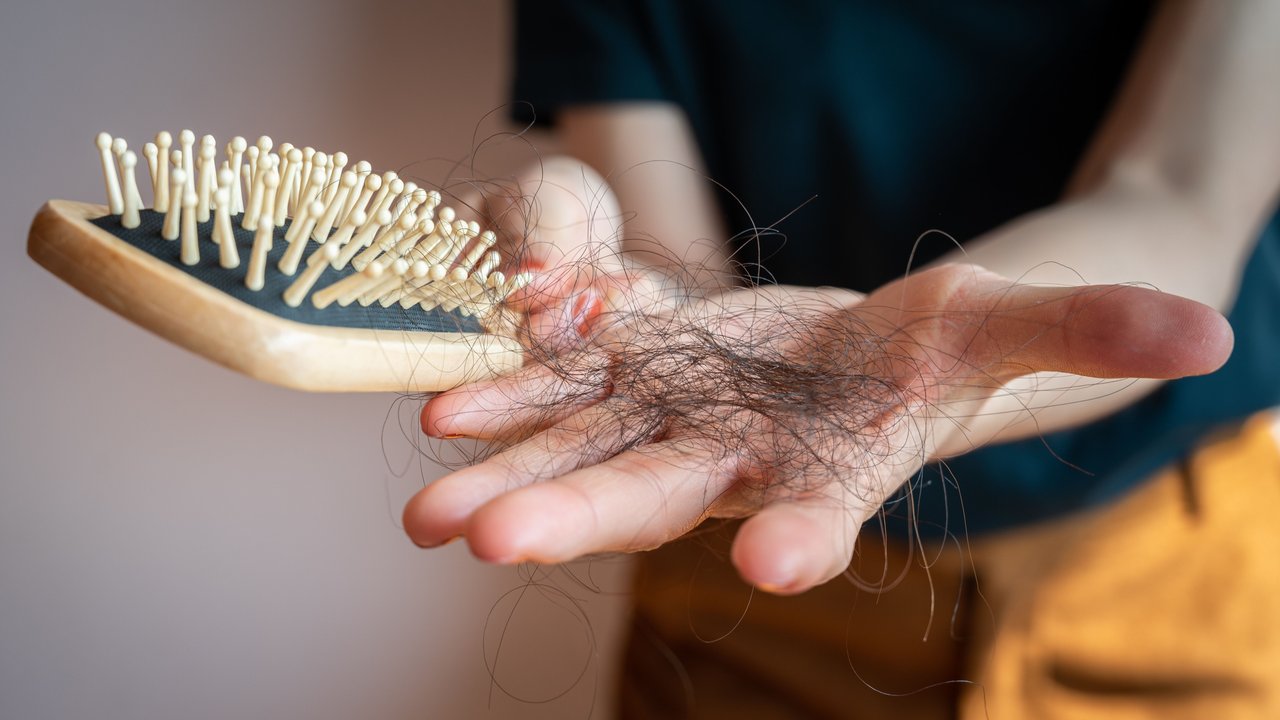 Bürste mit vielen ausgefallenen Haaren aufgrund von Haarausfall