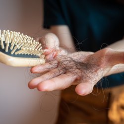 Mittel gegen Haarausfall: Diese Produkte halten wirklich, was sie versprechen