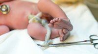 Nabelschnurblut: Einlagern, spenden oder auspulsieren lassen?