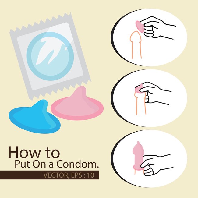 Kondom richtig überziehen Anleitung