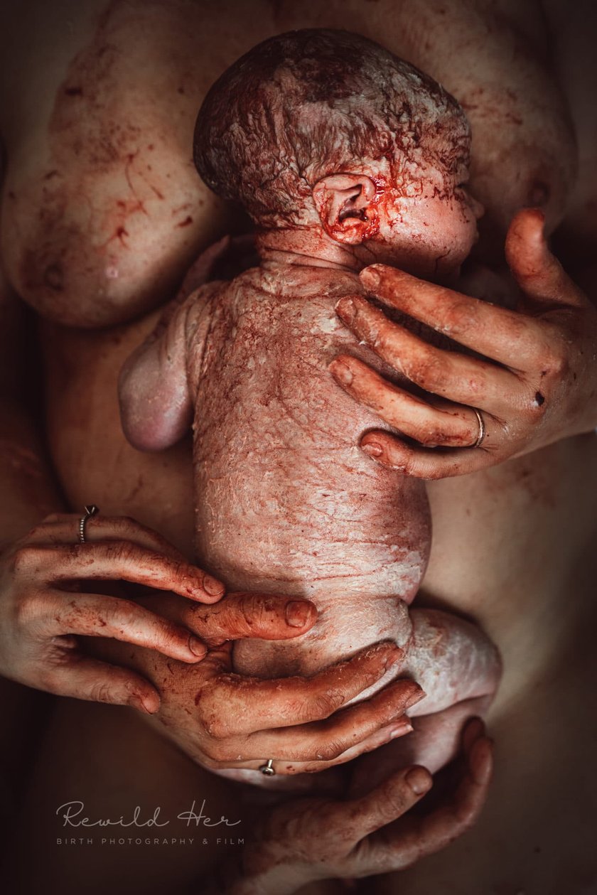 Fotos Neugeborenes nach Geburt