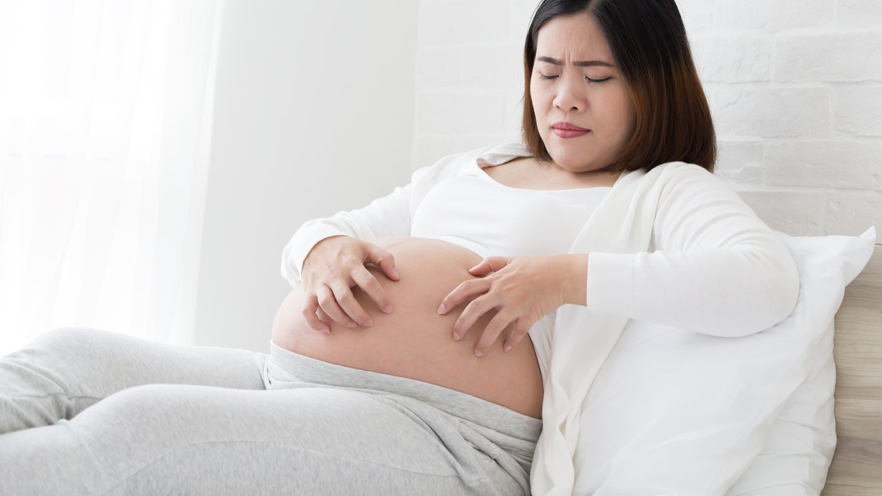 Southeast asian pregnant women itching of the skin belly which causes striped. Problems of pregnancy women and Stretch marks or striae concept