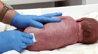 Vaginal Seeding: Vaginale Impfung für Kaiserschnitt-Babys